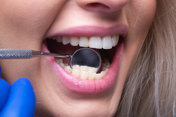 Tips On How To Care For Your Smile After A Dental Cleaning